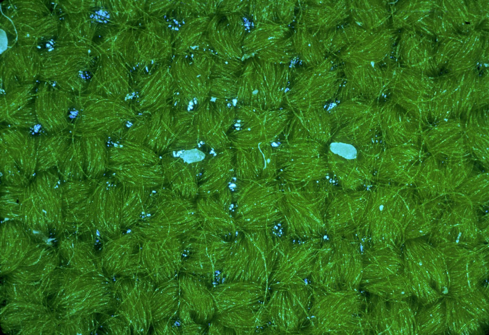 carpet beetle eggs on clothing