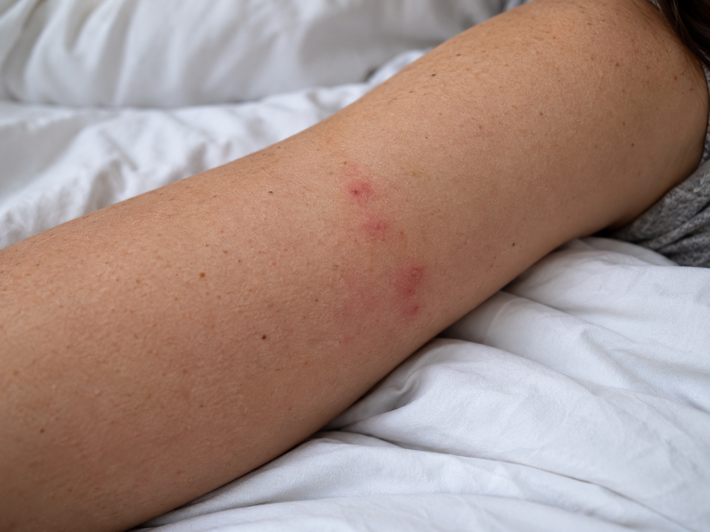 droppings bed bugs